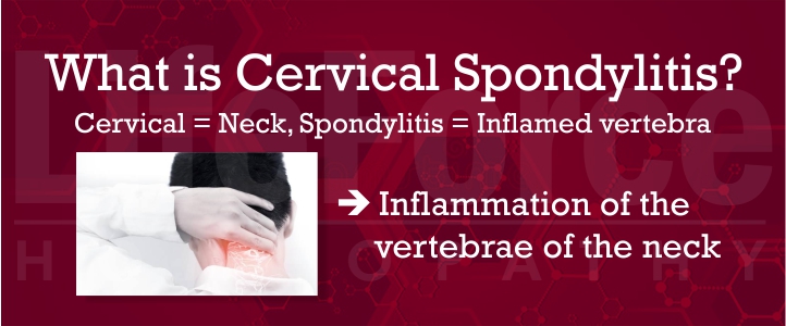 Cervical Spondylitis Treatment